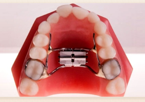 expander