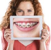 metalbraces